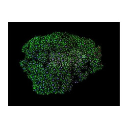 Pachyclavularia violacea - Star Polyp - Xenia Metallic Green Cult