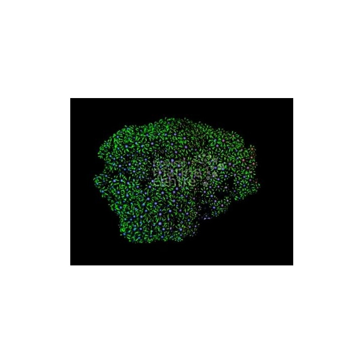 Pachyclavularia violacea - Star Polyp - Xenia Metallic Green Cult