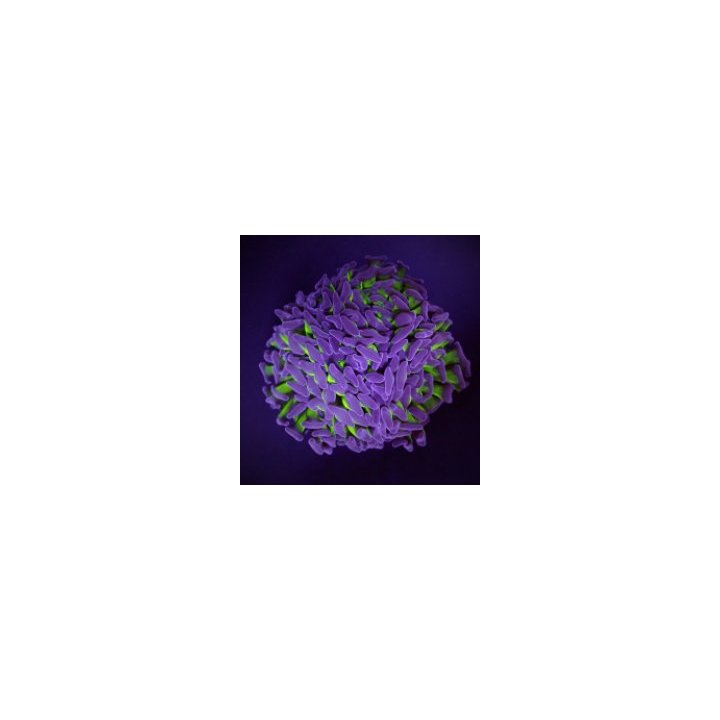 Euphyllia paraancora (Two Tone) (1 hd.) | LPS stony coral |…
